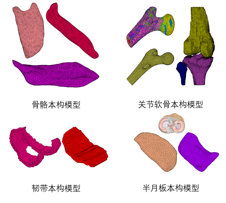 设计仿真 | 直播预告-Marc 仿真助力医学医疗研发创新的图4