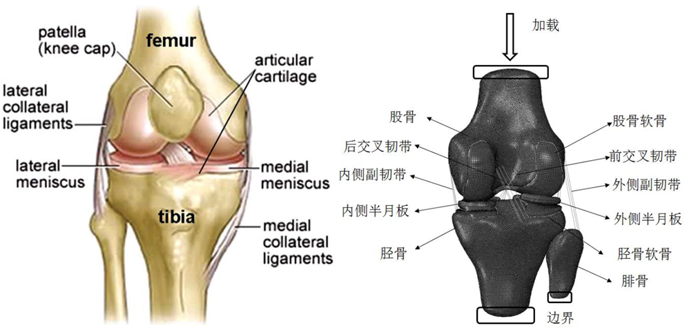 设计仿真 | 直播预告-Marc 仿真助力医学医疗研发创新的图3