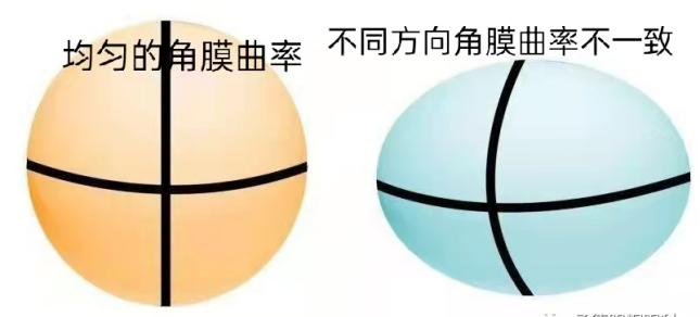 怎么测角膜直径【近视防控】一文读懂眼科光学生物测量之二——角膜曲率_https://www.jmylbn.com_新闻资讯_第5张