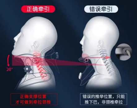 什么是费城颈托颈椎病患者看这里！你确定会选戴颈托吗？_https://www.jmylbn.com_新闻资讯_第12张