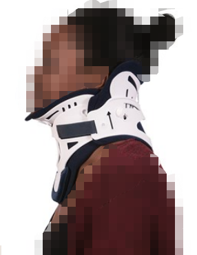 什么是费城颈托颈椎病患者看这里！你确定会选戴颈托吗？_https://www.jmylbn.com_新闻资讯_第18张