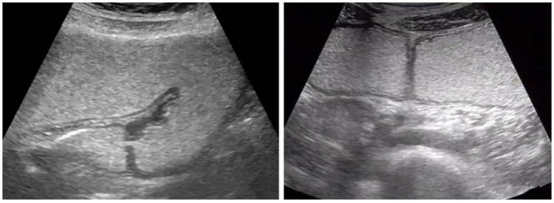 胃造影用的是什么机子【新技术 新项目】“超”能力 “胃”你解忧 ——胃肠不适怎么办，新医大二附院胃肠超声造影来帮你！_https://www.jmylbn.com_新闻资讯_第17张