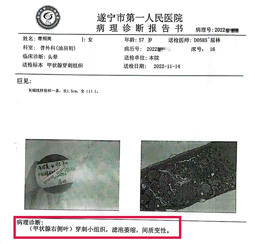 活检MM什么针功夫！_https://www.jmylbn.com_新闻资讯_第7张