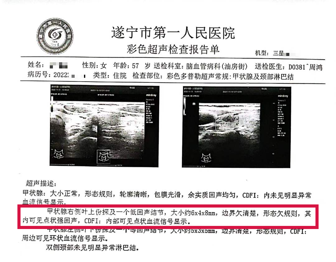 活检MM什么针功夫！_https://www.jmylbn.com_新闻资讯_第6张