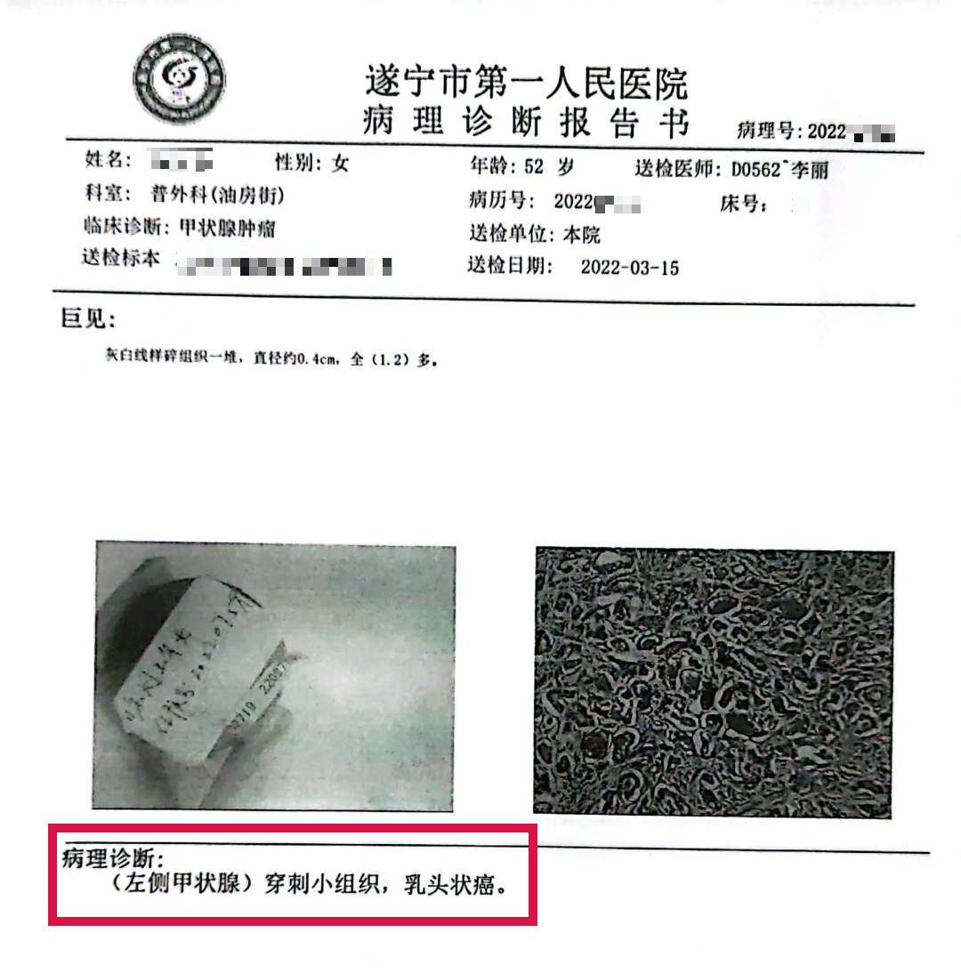 活检MM什么针功夫！_https://www.jmylbn.com_新闻资讯_第4张