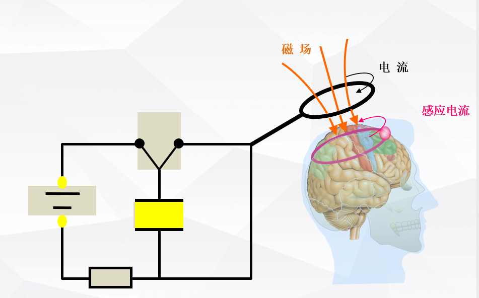 经颅磁治疗怎么样经颅磁刺激治疗脑卒中后遗症_https://www.jmylbn.com_新闻资讯_第5张