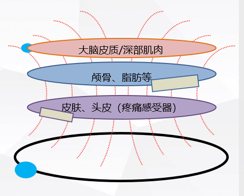 经颅磁治疗怎么样经颅磁刺激治疗脑卒中后遗症_https://www.jmylbn.com_新闻资讯_第3张