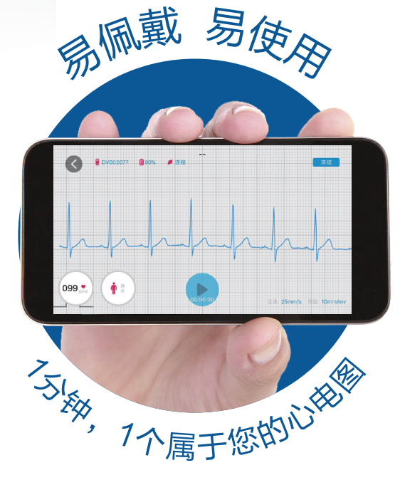 动态心电图仪器怎么看7天长时程动态心电图——您的心脏“记录仪”_https://www.jmylbn.com_新闻资讯_第3张