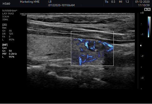 三星彩超怎么样AI辅助，更精准、更清晰！淮安三院引进两台三星XR7高档彩超_https://www.jmylbn.com_新闻资讯_第1张