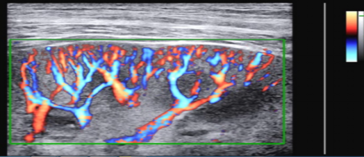 三星彩超怎么样AI辅助，更精准、更清晰！淮安三院引进两台三星XR7高档彩超_https://www.jmylbn.com_新闻资讯_第2张
