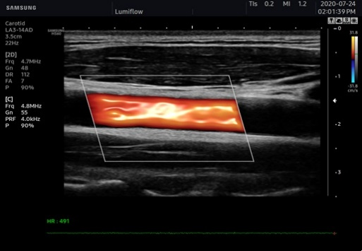 三星彩超怎么样AI辅助，更精准、更清晰！淮安三院引进两台三星XR7高档彩超_https://www.jmylbn.com_新闻资讯_第3张