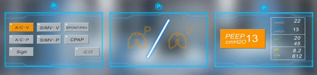 怎么查找医疗设备型号针对院前危重患者转运，如何选用合适型号的呼吸机_https://www.jmylbn.com_新闻资讯_第17张