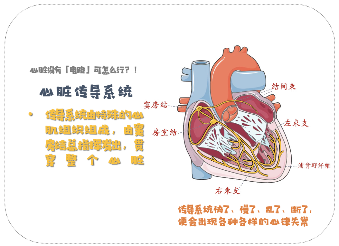 心律失常——室性早搏的诊疗