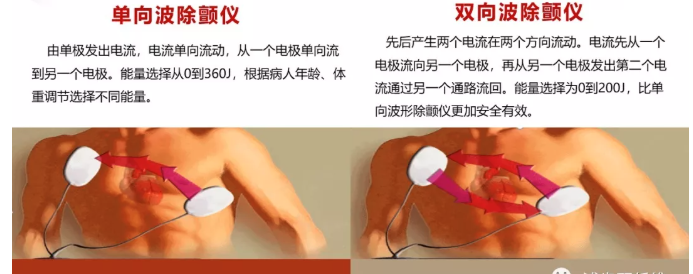 监护仪怎么使用早读 ｜ 除颤仪该如何正确使用？_https://www.jmylbn.com_新闻资讯_第7张