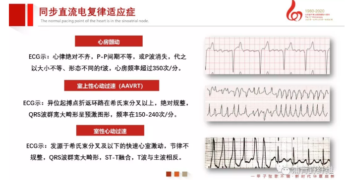 监护仪怎么使用早读 ｜ 除颤仪该如何正确使用？_https://www.jmylbn.com_新闻资讯_第11张