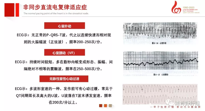 监护仪怎么使用早读 ｜ 除颤仪该如何正确使用？_https://www.jmylbn.com_新闻资讯_第10张