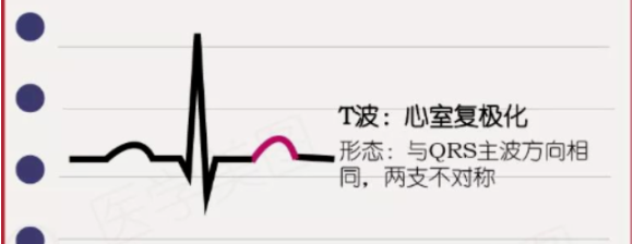 心律失常——房颤患者的紧急处置