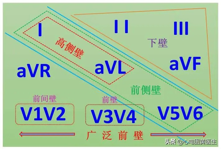 三甲规培教案：急性心肌梗死的临床大全