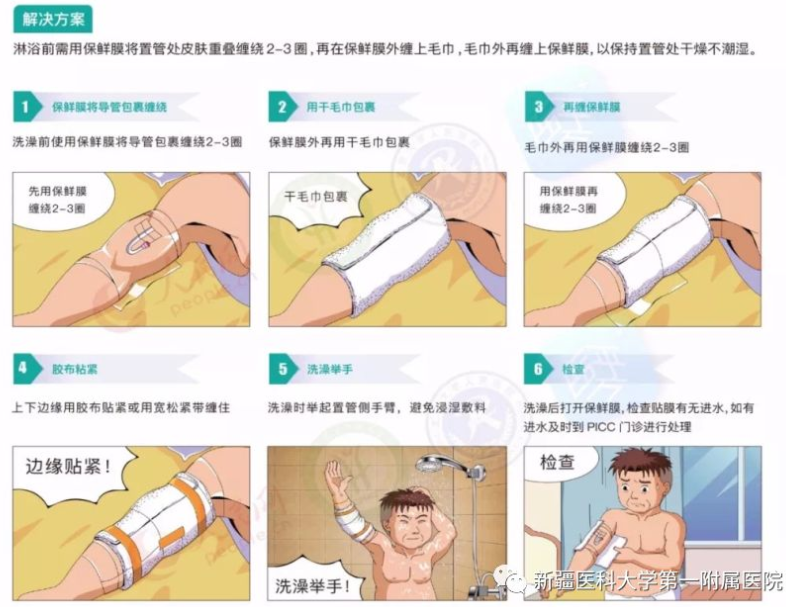 picc导管是什么材质【技术】picc置管技术及管路维护_https://www.jmylbn.com_新闻资讯_第5张