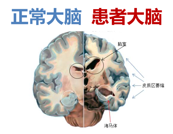 封东来：我爱物理的十个理由 行业新闻 第32张