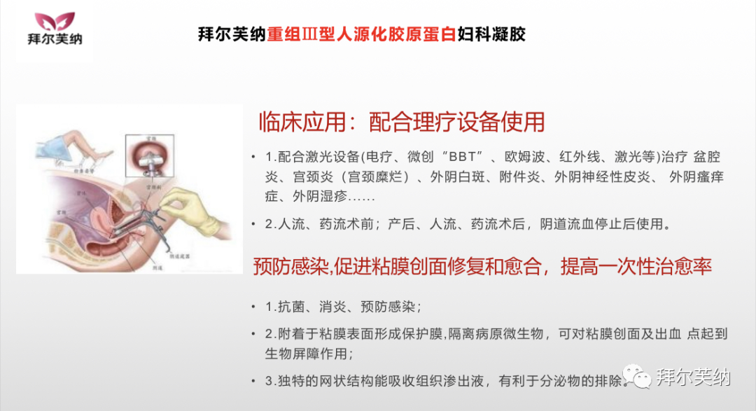 妇科蛋白膜怎么用产品介绍｜重组III型人源化胶原蛋白妇科凝胶_https://www.jmylbn.com_新闻资讯_第11张