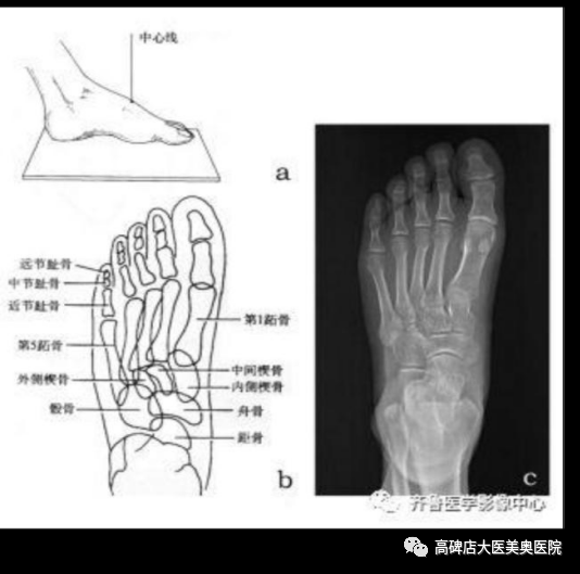 数字化摄影dr是什么DR常识知多少_https://www.jmylbn.com_新闻资讯_第5张