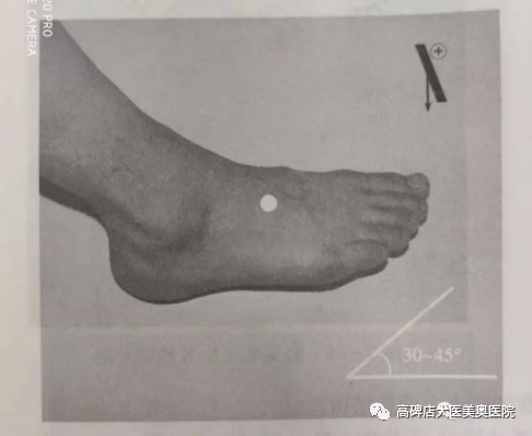 数字化摄影dr是什么DR常识知多少_https://www.jmylbn.com_新闻资讯_第8张