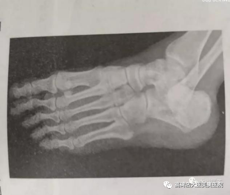 数字化摄影dr是什么DR常识知多少_https://www.jmylbn.com_新闻资讯_第6张