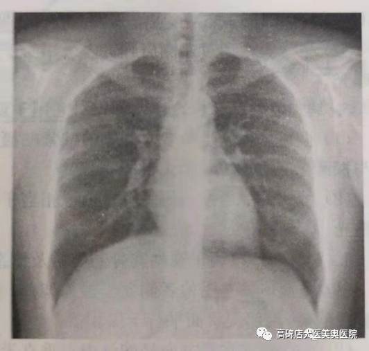 数字化摄影dr是什么DR常识知多少_https://www.jmylbn.com_新闻资讯_第3张