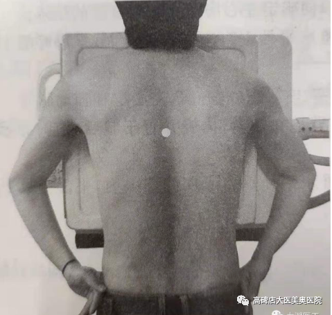 数字化摄影dr是什么DR常识知多少_https://www.jmylbn.com_新闻资讯_第4张