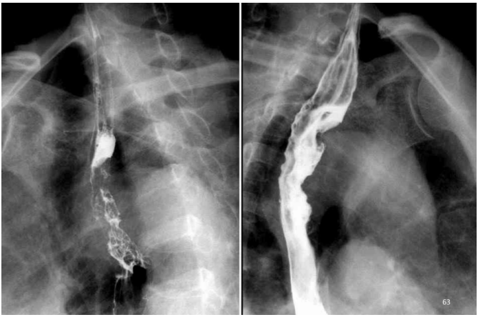dsa是什么设备【影像中心全景之DR／DSA专栏】人员、设备简介及DR／DSA技术成果展示_https://www.jmylbn.com_新闻资讯_第24张