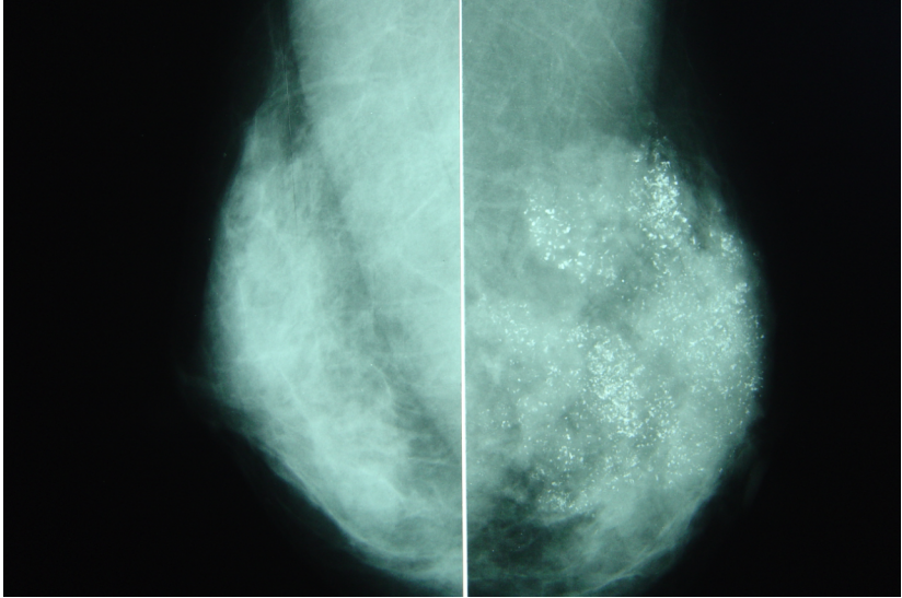 dsa是什么设备【影像中心全景之DR／DSA专栏】人员、设备简介及DR／DSA技术成果展示_https://www.jmylbn.com_新闻资讯_第20张