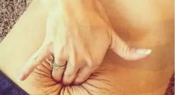 【产后修复】“腹直肌分离”大揭秘，胖和腹直肌分离要分清！