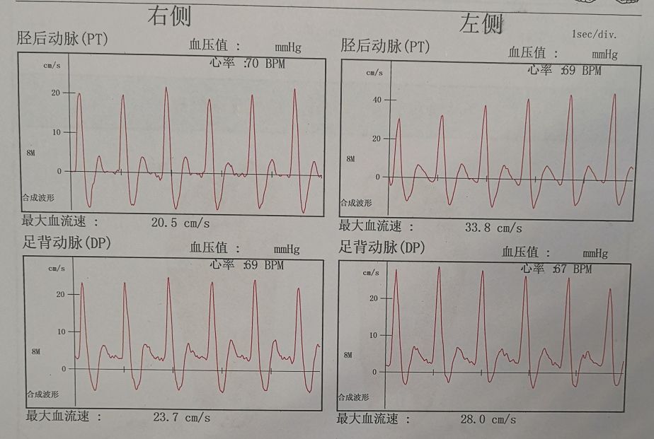 为什么糖尿病不能震动糖尿病足专科检查_https://www.jmylbn.com_新闻资讯_第18张