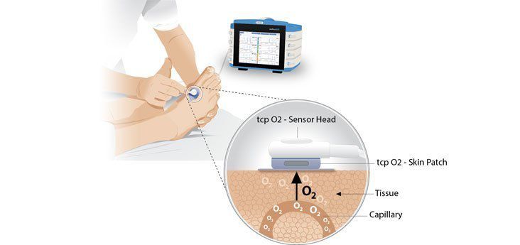 为什么糖尿病不能震动糖尿病足专科检查_https://www.jmylbn.com_新闻资讯_第20张