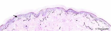 为什么糖尿病不能震动糖尿病足专科检查_https://www.jmylbn.com_新闻资讯_第15张