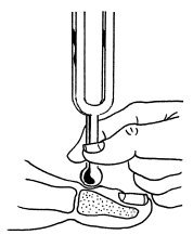 为什么糖尿病不能震动糖尿病足专科检查_https://www.jmylbn.com_新闻资讯_第10张