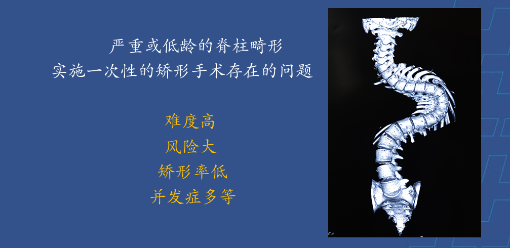 为什么会有单关节器械【临床用械】骨科用外固定支架的来源、应用介绍_https://www.jmylbn.com_新闻资讯_第28张
