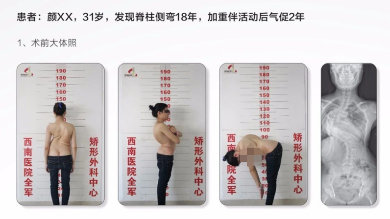 为什么会有单关节器械【临床用械】骨科用外固定支架的来源、应用介绍_https://www.jmylbn.com_新闻资讯_第30张