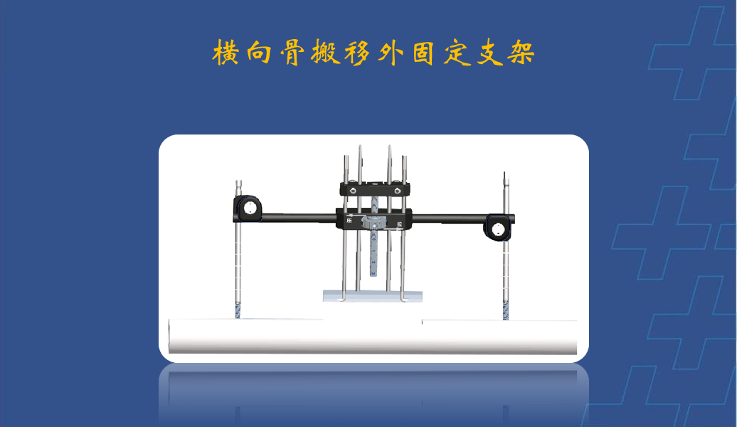 为什么会有单关节器械【临床用械】骨科用外固定支架的来源、应用介绍_https://www.jmylbn.com_新闻资讯_第17张