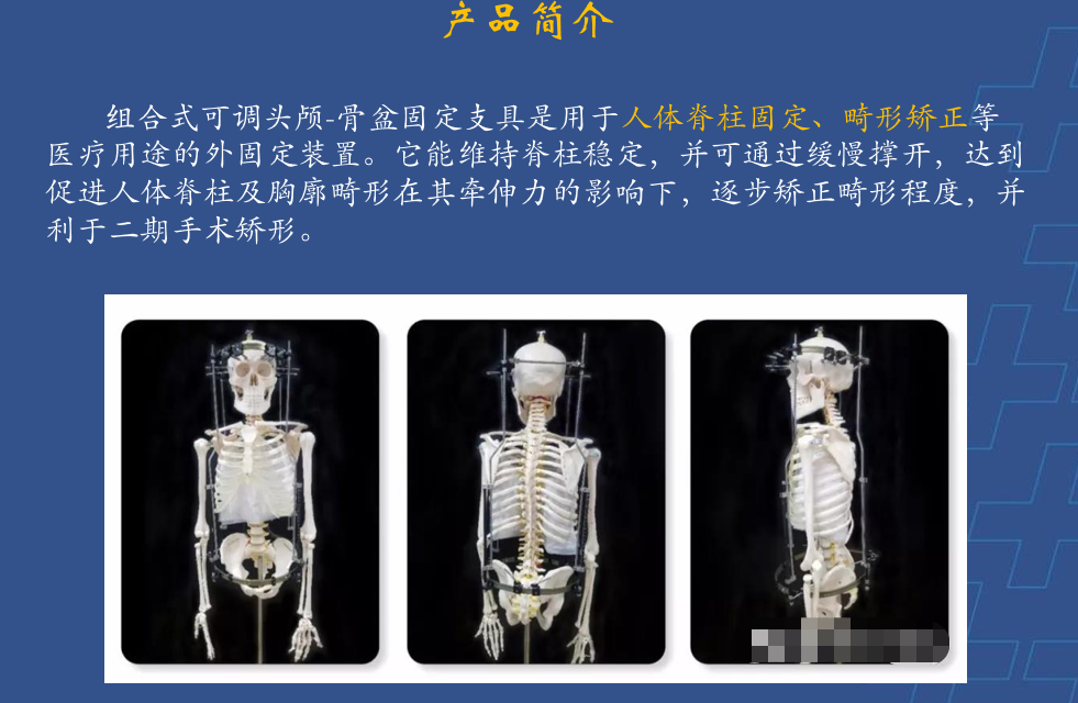 为什么会有单关节器械【临床用械】骨科用外固定支架的来源、应用介绍_https://www.jmylbn.com_新闻资讯_第27张
