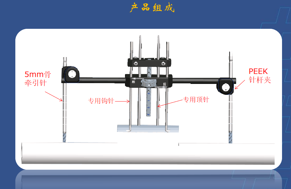 为什么会有单关节器械【临床用械】骨科用外固定支架的来源、应用介绍_https://www.jmylbn.com_新闻资讯_第19张