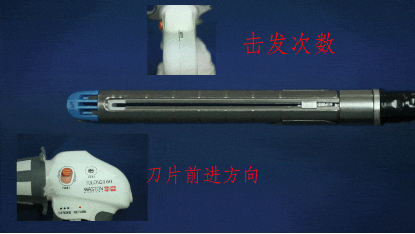 吻合器怎么用【临床用械】一次性使用腔镜切割吻合器（途龙II型）操作要点！！！_https://www.jmylbn.com_新闻资讯_第16张