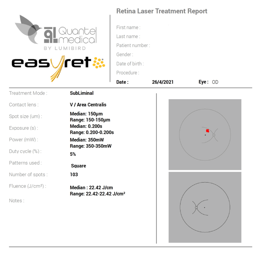 眼底激光机有什么牌子【高视光太EasyRet病例品鉴】巧手医中浆_https://www.jmylbn.com_新闻资讯_第7张