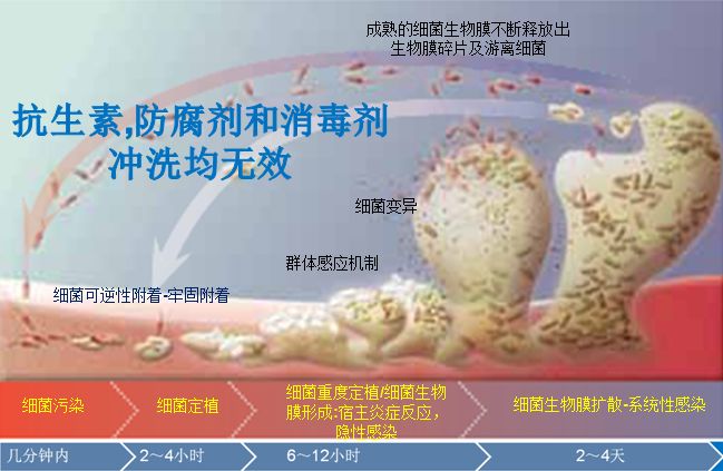 伤口凝胶敷料怎么用普朗特TM液体／凝胶敷料_https://www.jmylbn.com_新闻资讯_第6张