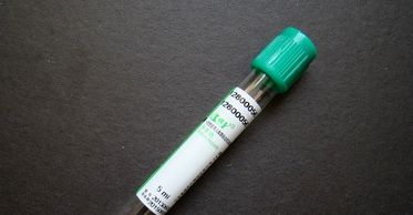 糖化血红蛋白用什么试管抽血试管知多少？_https://www.jmylbn.com_新闻资讯_第7张