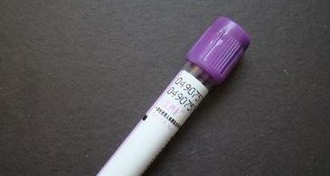 糖化血红蛋白用什么试管抽血试管知多少？_https://www.jmylbn.com_新闻资讯_第3张