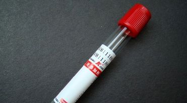 糖化血红蛋白用什么试管抽血试管知多少？_https://www.jmylbn.com_新闻资讯_第4张