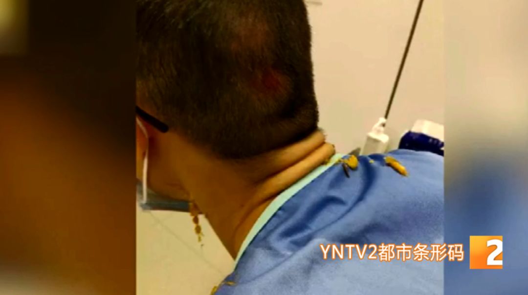 过度疲劳处理方法不包括_过度疲劳公司负责吗_云南人社局官网