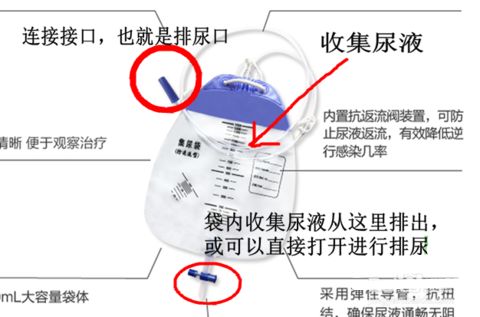 为什么要引流尿袋留置尿管护理必须掌握的操作要点——高清动图操作教学_https://www.jmylbn.com_新闻资讯_第7张
